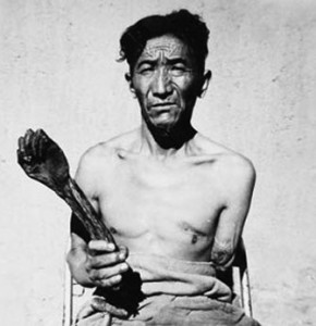 serf_with_arm