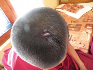 wounded_monk1