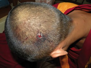 wounded_monk3